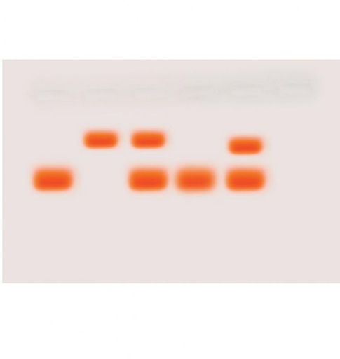 Kit anémie falciforme