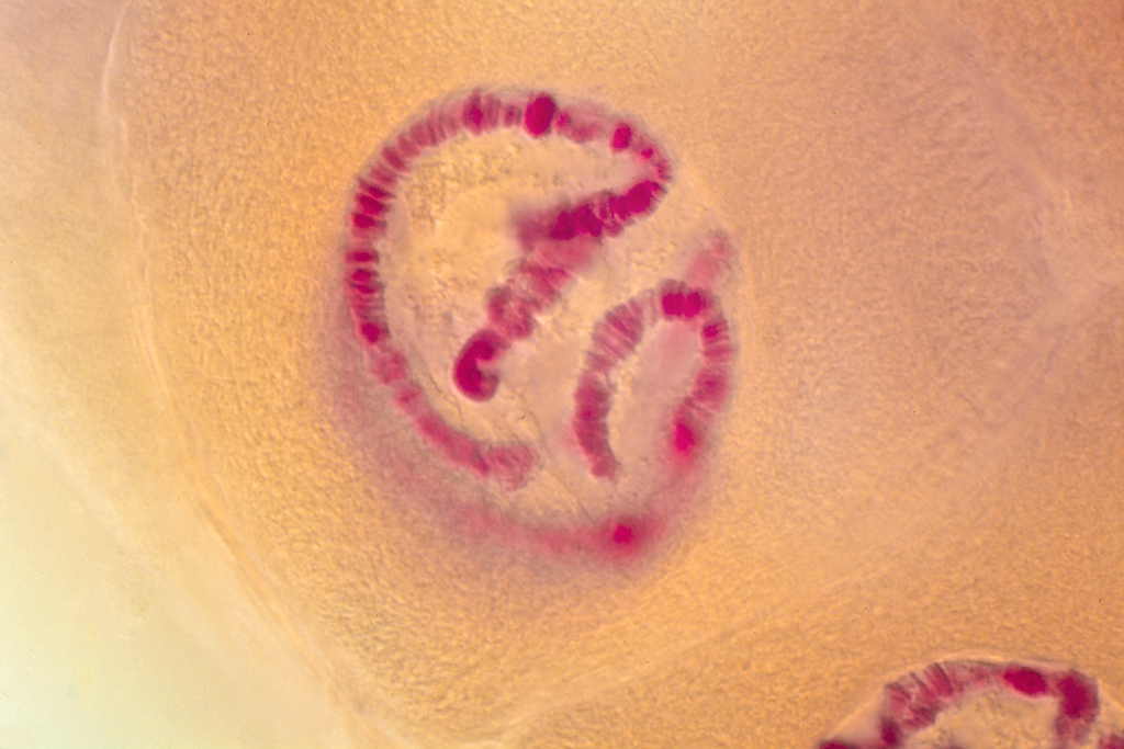 Chromosomes géants - gl.saliv. - larve Chironome - F - Nublat